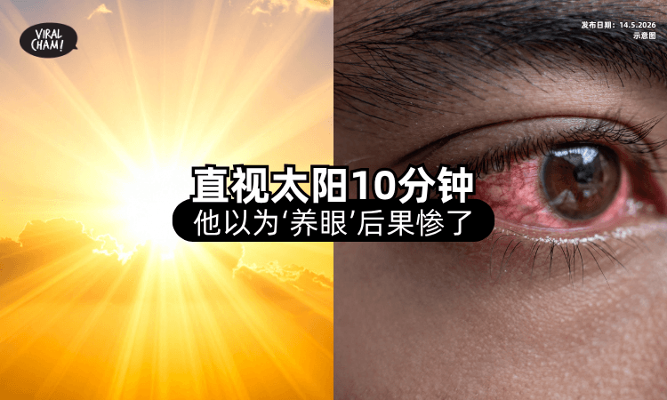 【晒眼能护眼❓】男子突发奇想「直视太阳10分钟⚡」视力降至0.4！