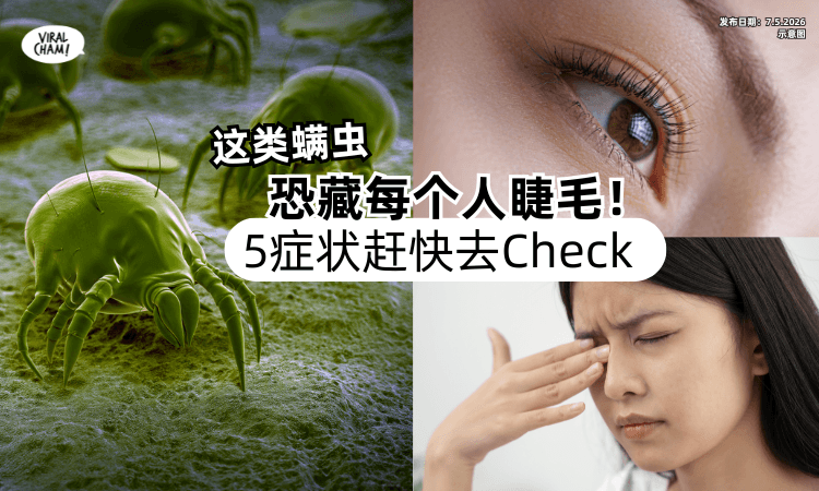 【你可能也有❗】这类螨虫「恐藏每个人睫毛⚡」医示警“5症状”赶快去Check！