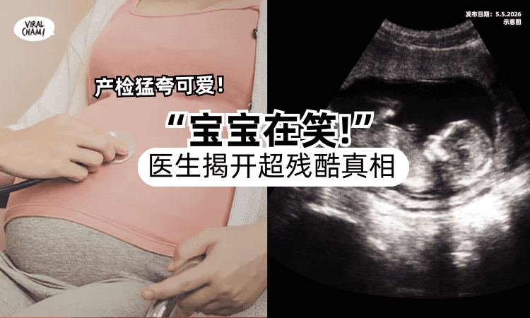 【宝宝在笑❗】夫妇产检「猛夸可爱」医生一Check⚡揭开“超残酷真相”！