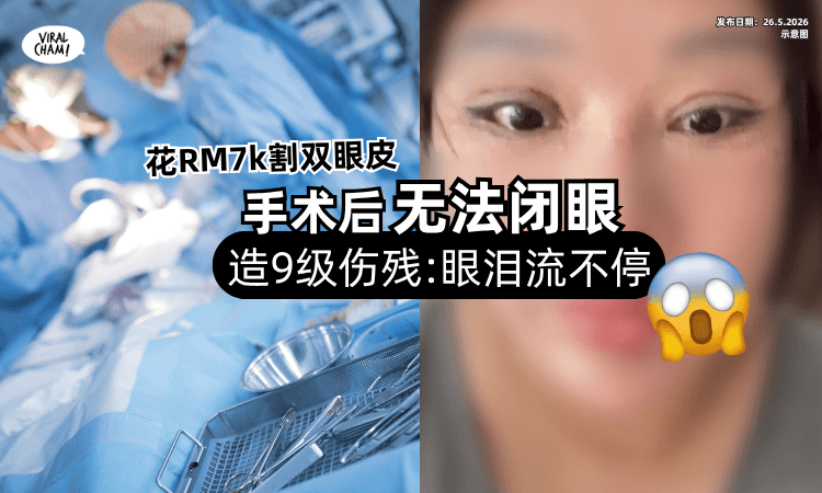 【花RM7k割双眼皮❗】女子术后「无法闭眼」造成9级伤残⚡控诉 : 眼泪流不停！