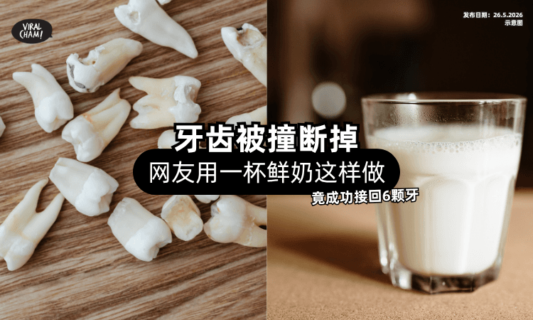 【牙齿被撞断掉❗】网友「秒求一杯鲜奶」这样做⚡ 送医竟成功接回6颗牙！