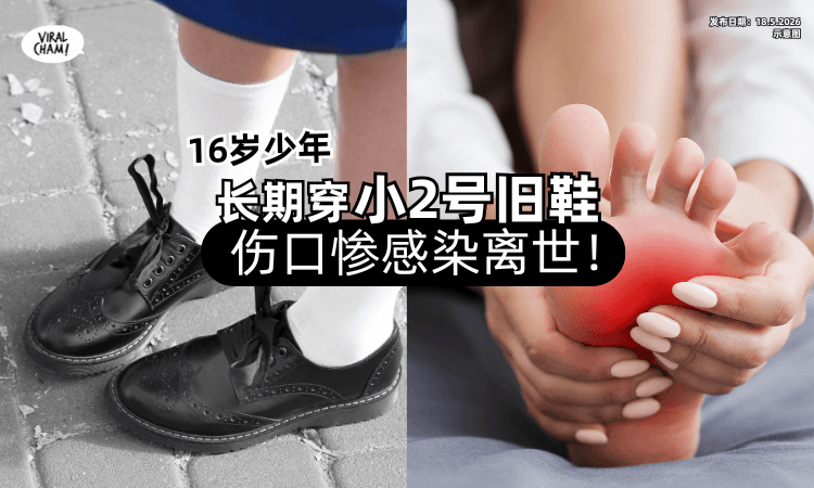 【忍痛2年❗】16岁贫穷少年长期穿「小2号旧鞋」伤口惨感染⚡不幸离世！