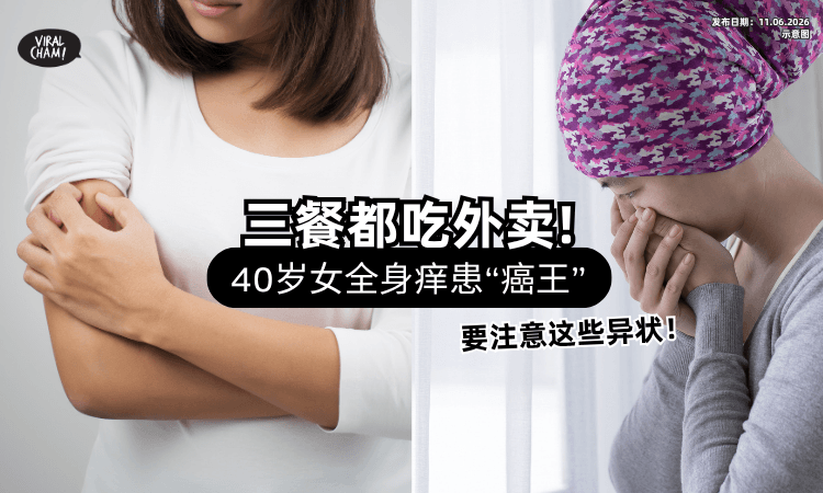 【三餐都吃外卖❗】40岁女全身「痒到想用钢丝球抓」确诊胆管癌⚡ 医警告：有症状恐已恶化！