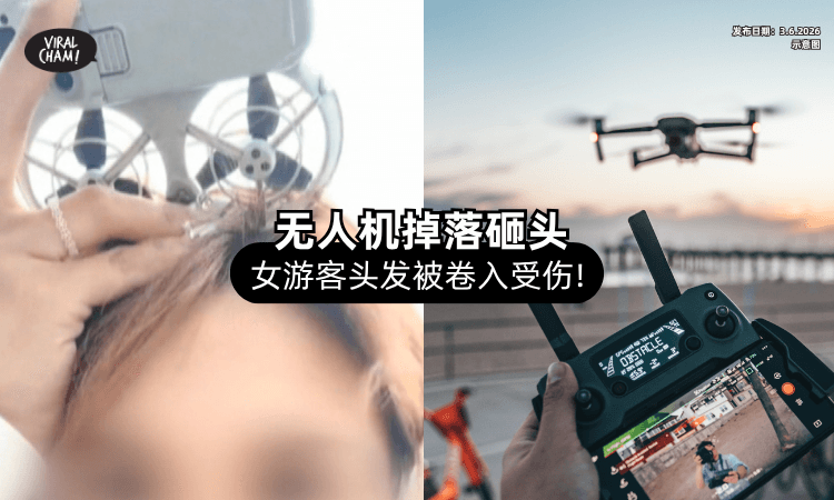 【飞来横祸❗】无人机掉落「女游客遭砸头⚡」头皮被绞惨失300多根头发！