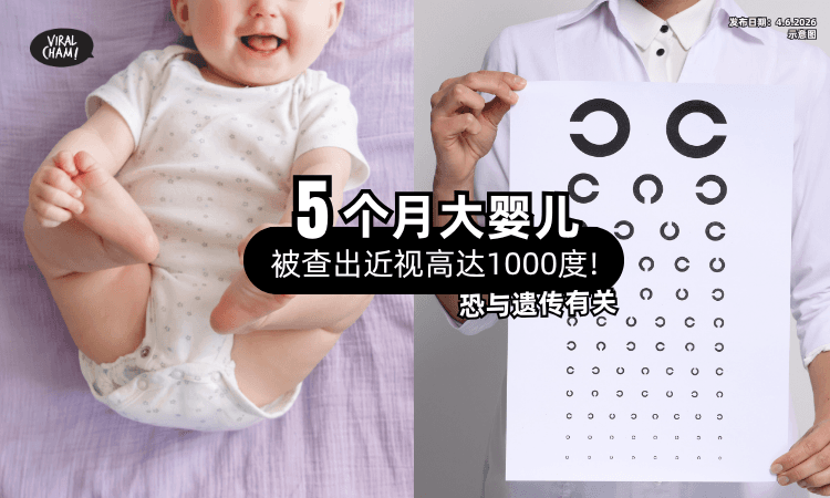【才5个月大❗】新生儿竟有「1000度近视⚡」医生示警：恐与遗传有关
