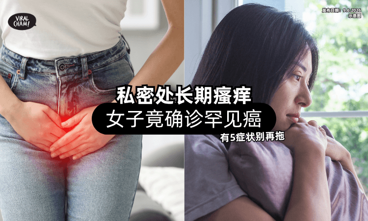 【居然是Cancer前兆❗】私密处瘙痒竟确诊「罕见癌⚡」医生：这5症状别再拖！