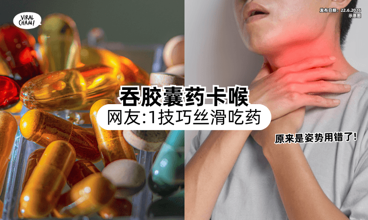 【吞胶囊药卡喉❗】原来是姿势用错了⚡ 网友分享「这小技巧」丝滑吃药！
