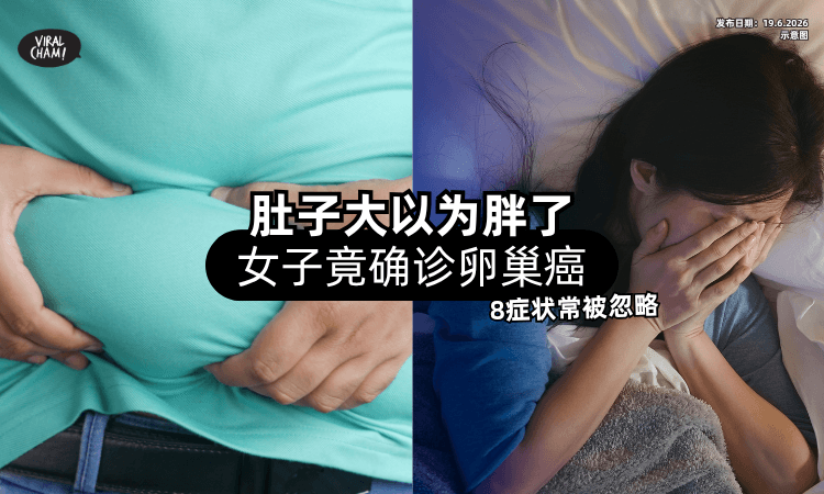 【肚子大以为胖了❗】女子一查竟确诊「卵巢癌⚡」医生：8症状常被忽略！
