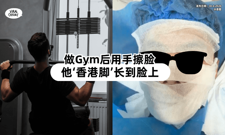 【健身党注意⚠️】做Gym后用手擦脸⚡ 男子「香港脚」长到脸上！