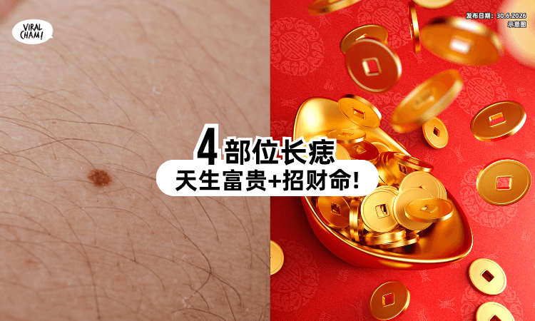 【别急着点掉❗】4部位长痣被称「暗财痣⚡」命理师曝：容易招财+迎好运！