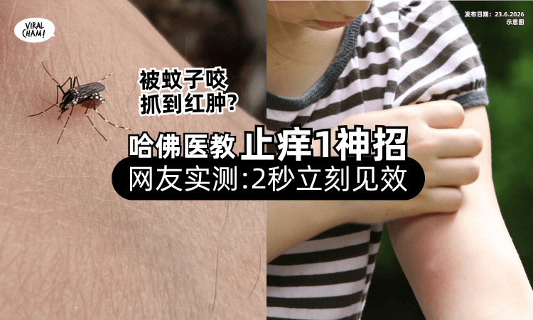 【被蚊子叮别乱抓❗】哈佛医生教「止痒1神招⚡」网友实测惊呼 : 2秒见效！