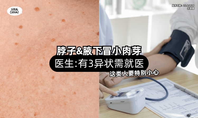 【这类人要小心❗】脖子和腋下「冒出小肉芽⚡」医生警告：有3异状需就医！