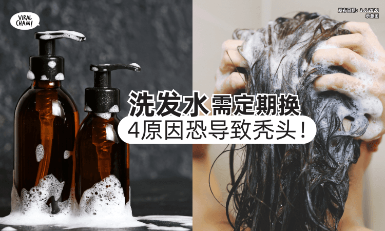 【每3个月要Check一次❗】医生揭「洗发水」要定期换⚡“4原因”恐引发秃头！