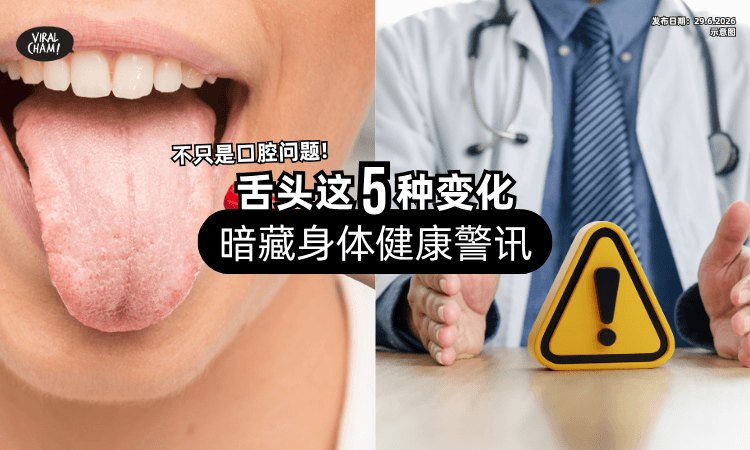 【不只是口腔问题❗】舌头「这5种变化」要注意⚡ 营养师：暗藏健康警讯！