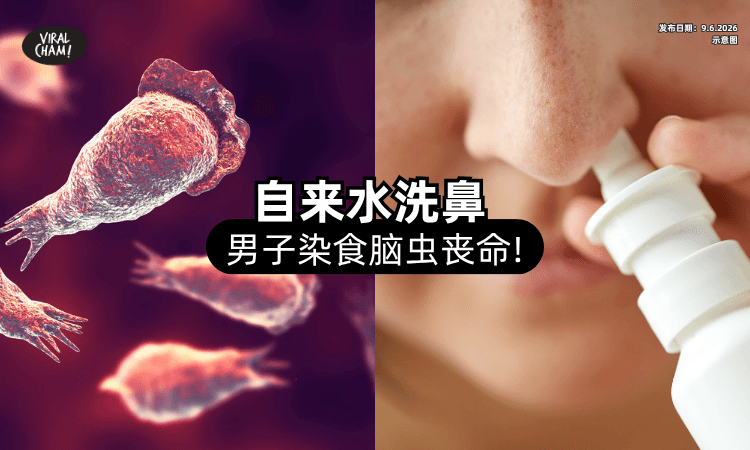 【自来水洗鼻中招❗】男子染「食脑虫」丧命⚡ 专家分享4招教你如何防护！