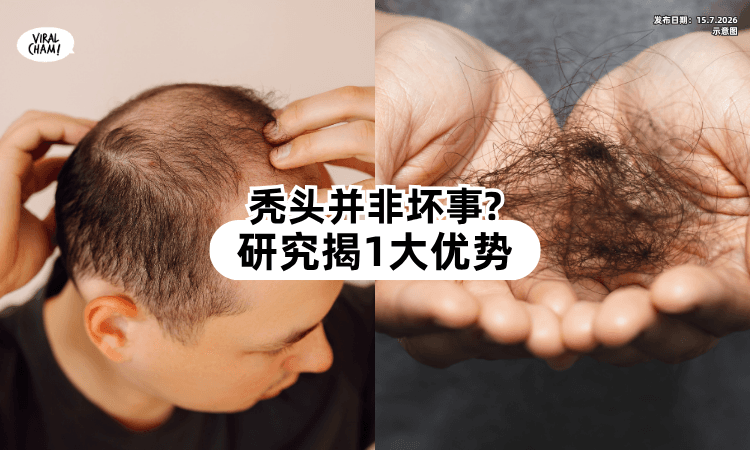 【秃头有好处❓】研究发现「男性掉发」不一定是坏事⚡