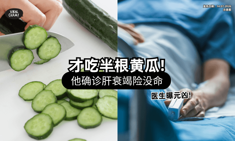 【才吃了半根黄瓜❗】男子中毒送急诊「确诊肝衰竭」险死⚡ 医曝元凶：这样吃比砒霜还毒！