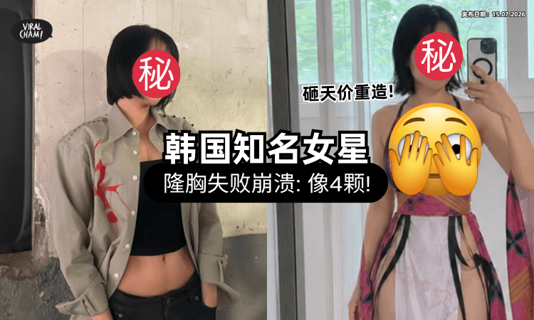 【胸部变4个❗】韩国知名女星自曝隆乳失败⚡「砸天价重造」惊人近照曝光！