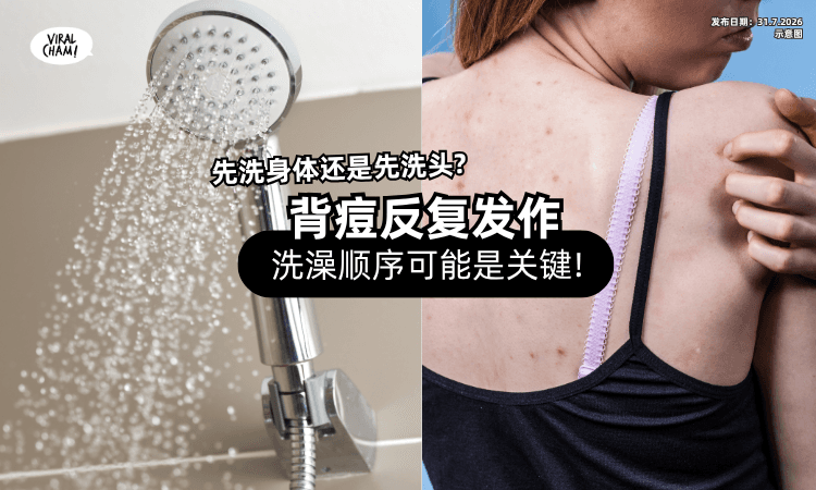 【先洗身体还是先洗头❓】背部长痘的元凶⚡ 可能藏在「洗澡顺序」里!