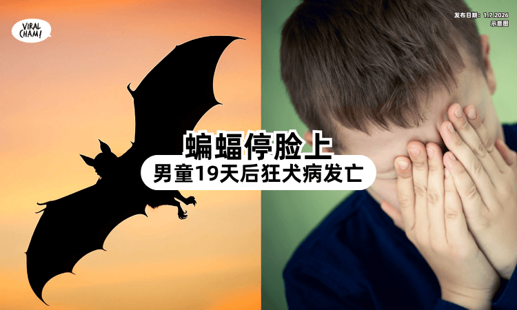 【死亡率几乎达100%❗】男童遭「蝙蝠停在脸上⚡」19天后狂犬病发离世！