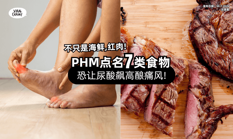 【痛风不是只因海鲜❗】大马公共卫生点名「7类食物⚡」很多人天天都在吃