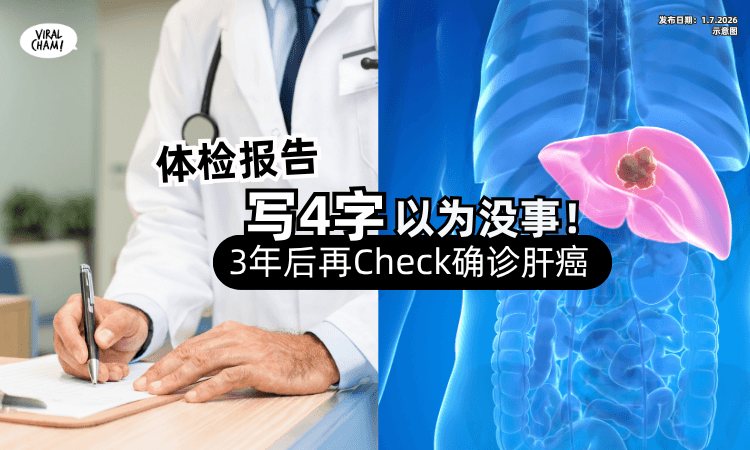 【只是参考❓】体检报告「写4字」以为无事⚡医揭真相 : 再Check已是肝癌第3期
