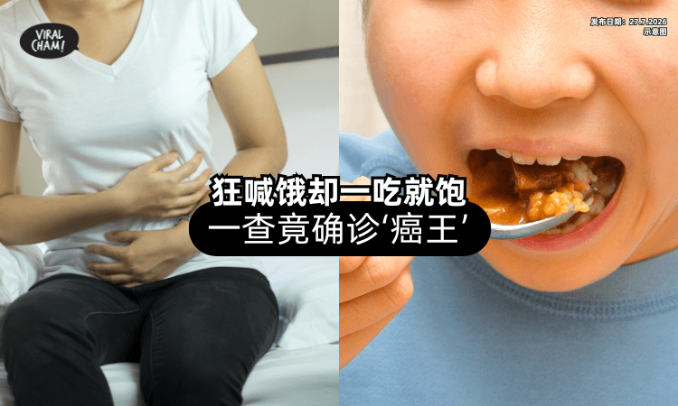 【很矛盾❗】她频频喊饿「却一吃就饱⚡」医生一查：竟是“癌王”作怪！