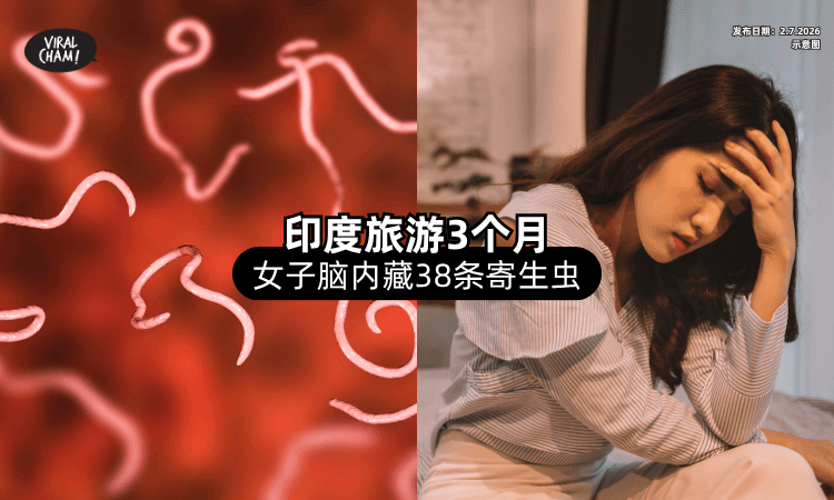 【印度旅游3个月❗】女子回国后频繁头痛⚡ 检察惊见脑内藏「38条寄生虫」！