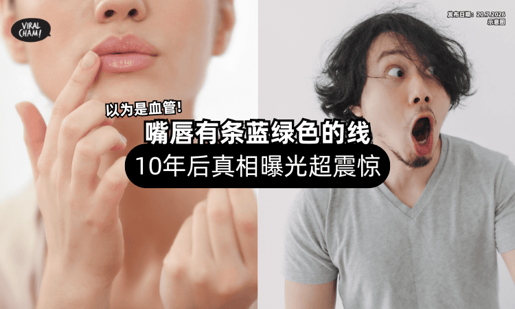 【以为是血管❗】嘴唇有条蓝绿色的线⚡「10年后真相曝光」吓坏众人！