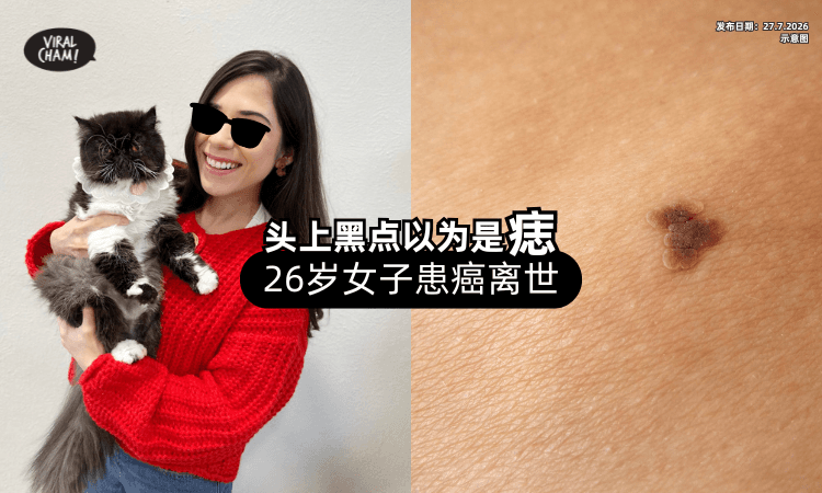 【头上一颗痣竟是癌❗】26岁女子一查已是「第四期⚡」扩散全身病逝！