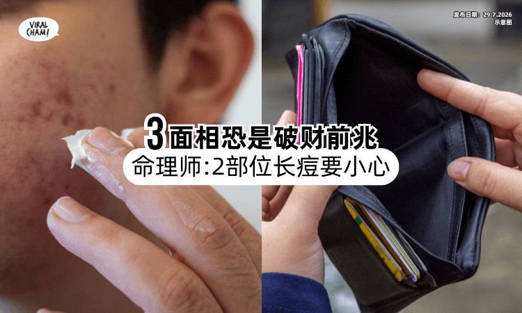 【一直都在花钱❗】命理师曝「这3面相」恐是破财前兆⚡ 2部位长痘要小心！