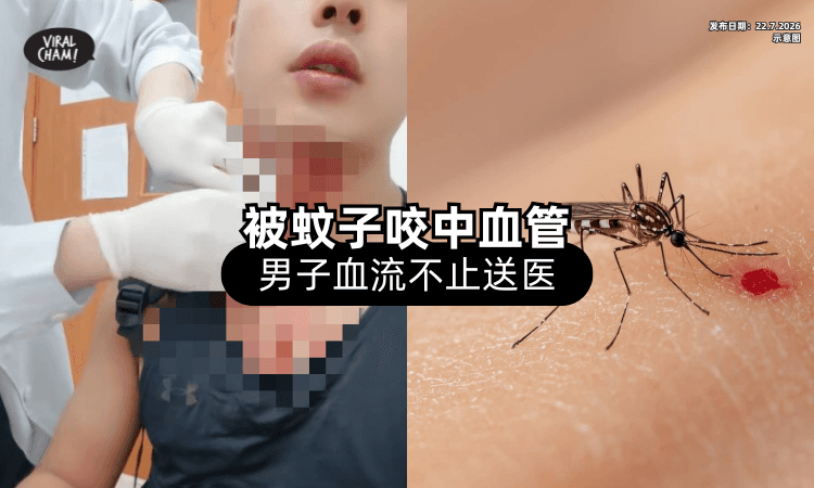 【差点被蚊子“杀死”❗】健身男被叮中「颈部血管⚡」血流不止急送医！