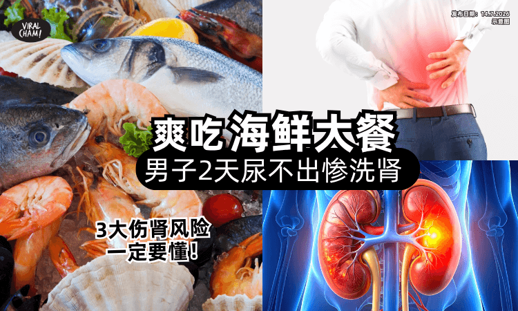 【3大伤肾风险❗】男子爽吃海鲜大餐「2天后尿不出来⚡」他送医急洗肾！