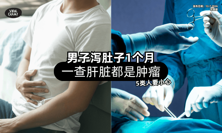 【泻肚子1个月❗】男子一check「肝脏都是肿瘤⚡」医生：5种人要小心！