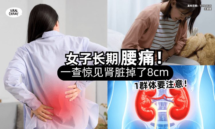 【长期腰痛+想吐❗】30岁女子一查惊见「肾脏掉了8cm⚡」医生 : 1群体最危险！