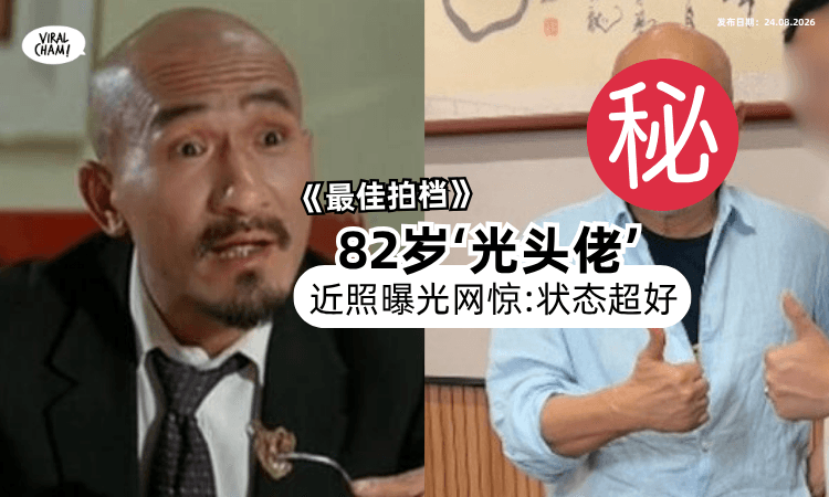 【出演《最佳拍档》爆红❗️】82岁“光头佬”麦嘉「近况曝光⚡️」网惊叹: 他像50出头！