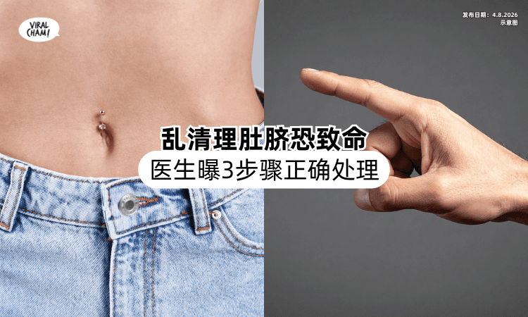 【乱清理恐致命❗】女子不敢清「肚脐黑到发亮⚡」医生曝3步骤正确处理！