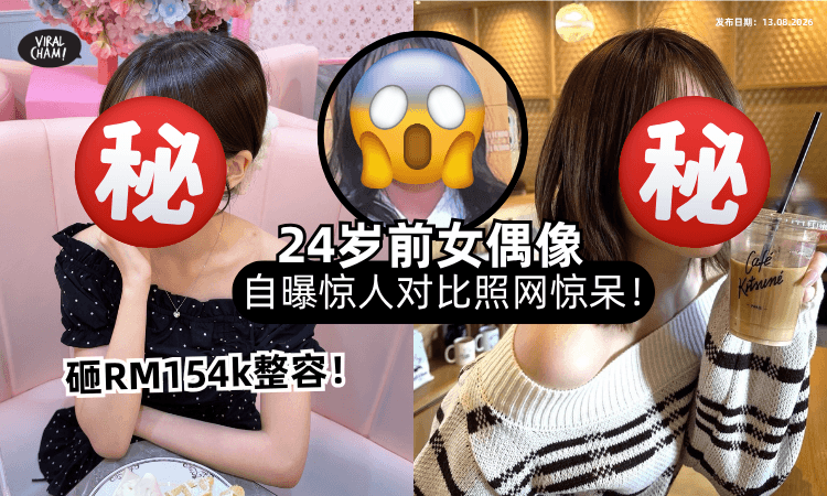 【国中就开始整形❗️】24岁前女偶像砸RM154,000换脸「惊人对比照⚡️」全场看傻眼！