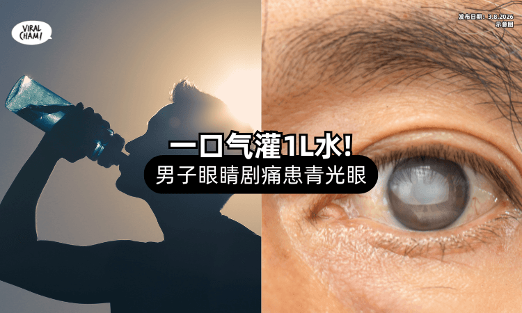 【一口气灌1L水❗】男子眼睛剧痛送医⚡ 竟确诊「青光眼」！