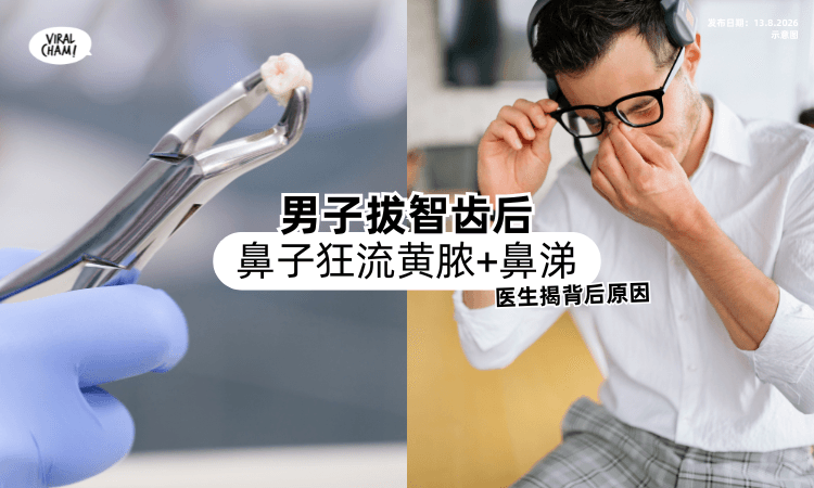 【拔智齿后惨了❗】男子鼻子狂流「黄脓+鼻涕⚡」医生揭开背后原因！