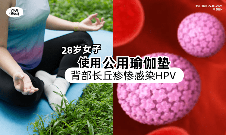 【背部突然冒小疙瘩❗️】28岁女子用「公用瑜伽垫」超痒⚡️惨感染HPV！