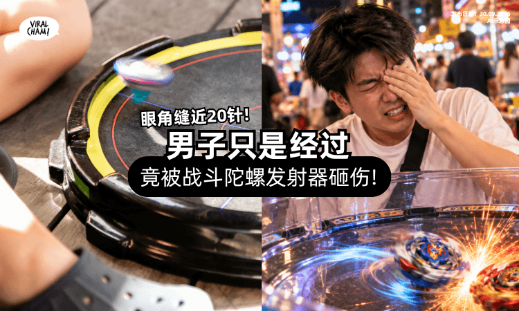 【只是经过也中招❗】少年操作「战斗陀螺⚡」路人无辜被砸伤眼睛惨缝针!