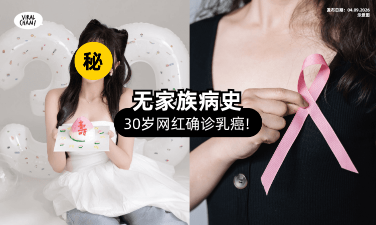 【无家族病史❗】30岁网红证实「罹患乳癌⚡」检查发现4颗肿瘤