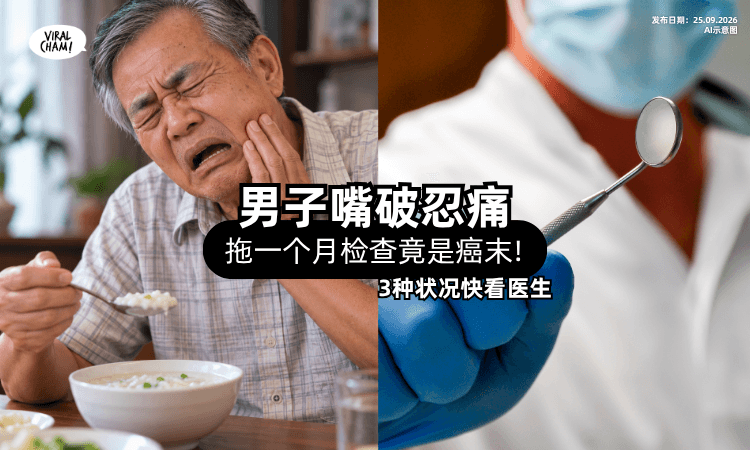 【3种状况快看医生❗】男子嘴破「忍痛拖一个月⚡」检查竟已是口腔癌末期!