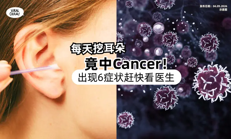 【每天都要挖❗️】爽掏耳朵竟中Cancer⚡️ 医警告 : 出现「6症状」快求医！