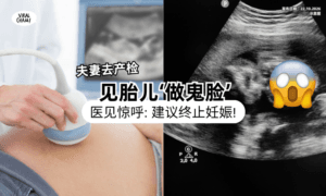 【在肚子里狂动❗】夫妻产检见胎儿「做鬼脸」大赞可爱⚡ 医见不妥：建议终止怀孕！