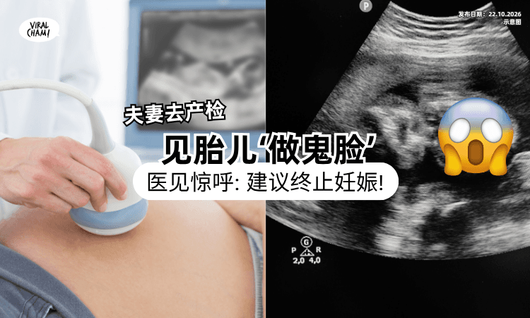 【在肚子里狂动❗】夫妻产检见胎儿「做鬼脸」大赞可爱⚡ 医见不妥：建议终止怀孕！