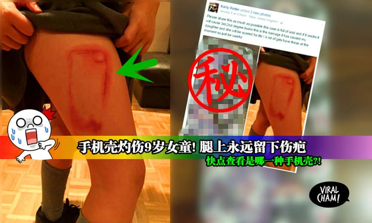 【千万不要用这种手机壳!】powerbank会爆炸、充电会漏电, 现在连手机壳都不安全…  网民：share出去提醒身边朋友!