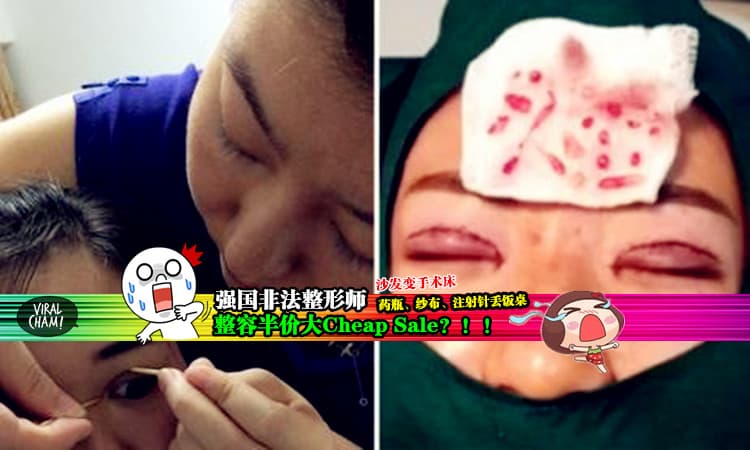 【毁容当教顺？】市场上出现整形手术便宜一半，但设备器材就简陋不堪，你敢Try吗？ 小编就怕怕了~(@~@)