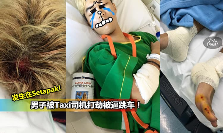 發生在Setapak!【Taxi司機的Part Time是打劫?】男子直接跳車導致身體多處受傷！